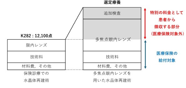 多焦点眼内レンズ