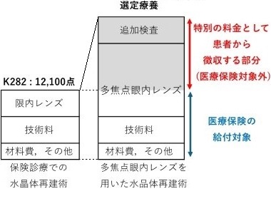 多焦点眼内レンズ